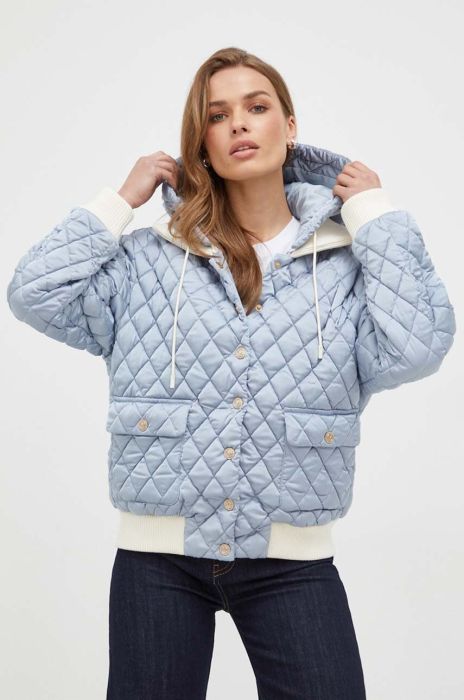 Пухова куртка Miss Sixty жіноча перехідна oversize колір блакитний