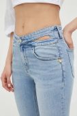 Джинси Miss Sixty жіночі висока посадка колір блакитний (3197347)